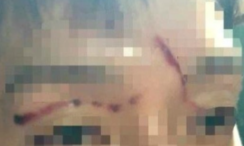 0003396560_001_20180917091837331