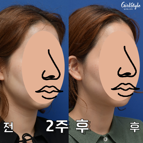 카드이미지1_대지 1