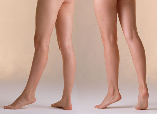 dr_leg_12