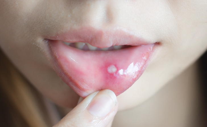 다운로드 (1)