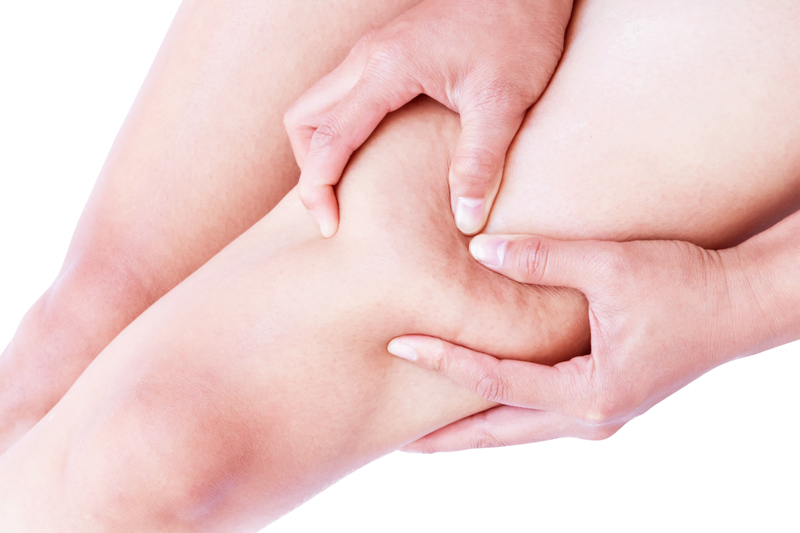 Closeup woman hand holding the skin of legs cellulite for beauty care concept
